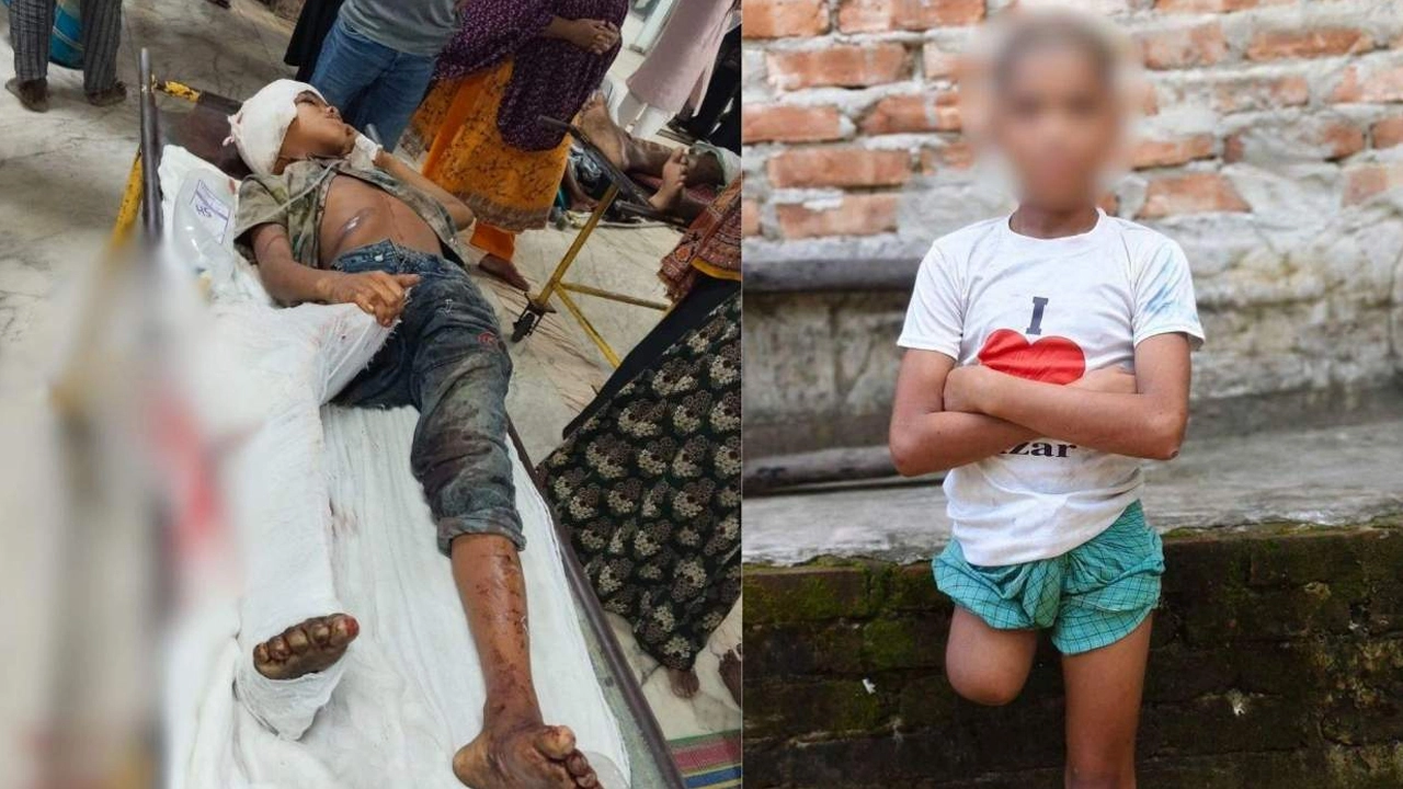 ট্রেন দুর্ঘটনায় পা হারানো সেই রায়হান